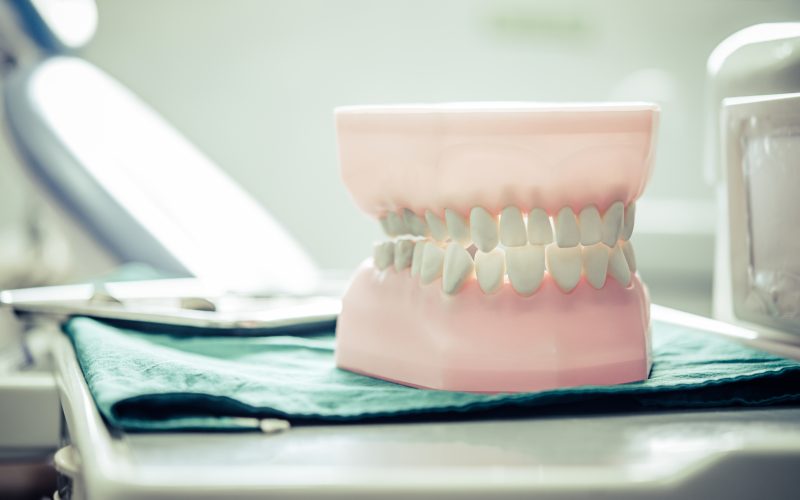 Dentures placed on a table in the laboratory